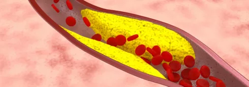 CHE COS’È IL COLESTEROLO