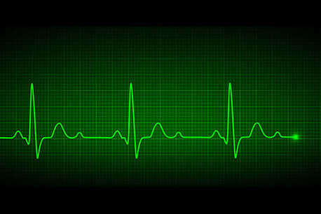 Scompenso cardiaco e infarto sono due cose diverse.