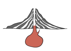 Colesterolo LDL formazione placca aterosclerosi_2