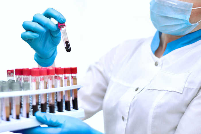 Scompenso cardiaco: le variazioni di NT-proBNP indicatori del rischio