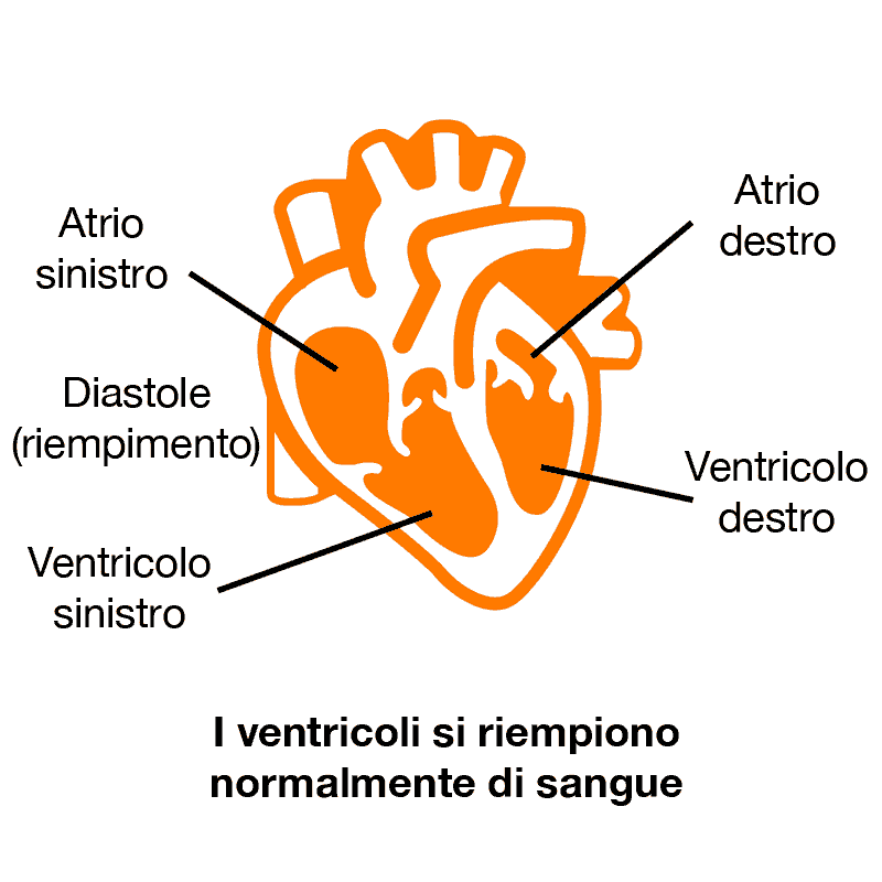 frazione di eiezione